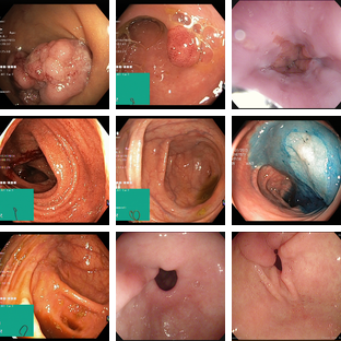 Kvasir