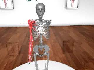 MyoArm
