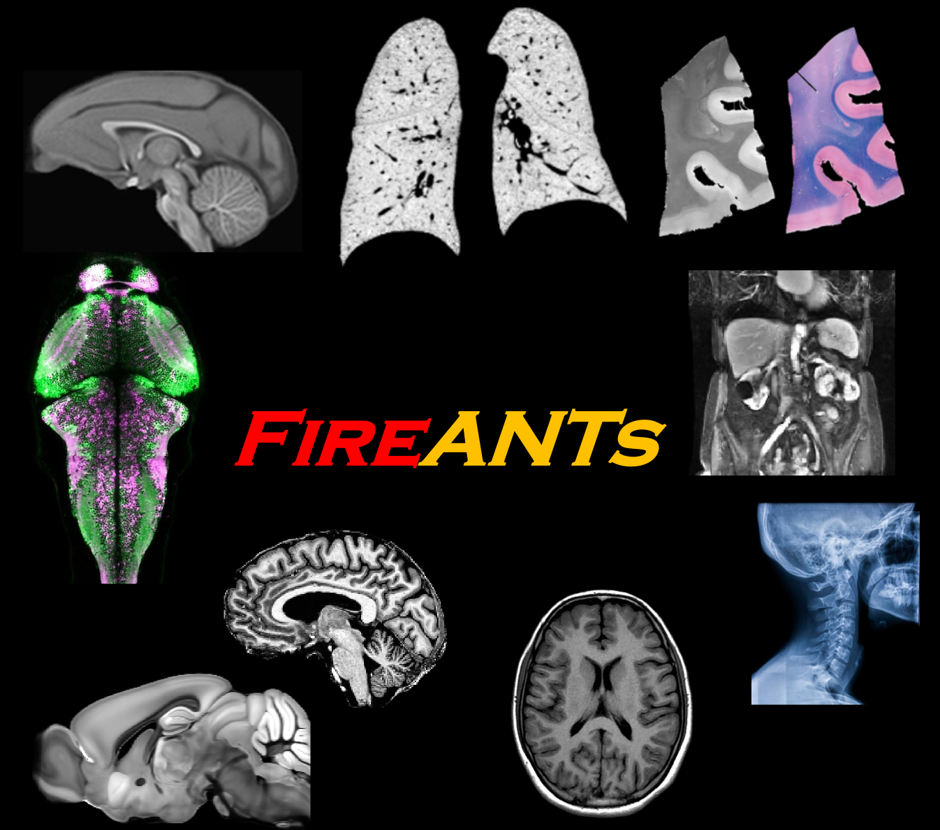 FireANTs